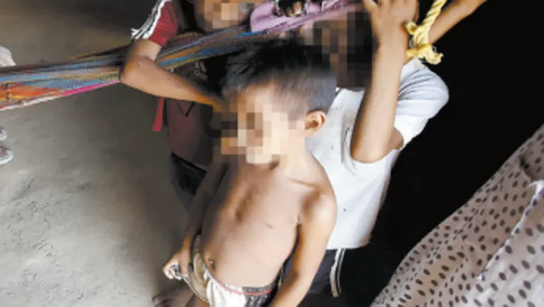 Aumenta desnutrición hasta 87.6% en Nuevo León