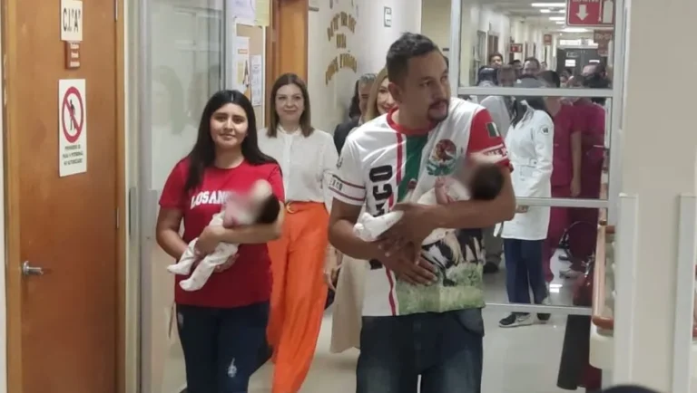 Dan de alta a siamesa que permanecía en hospital de Nuevo León